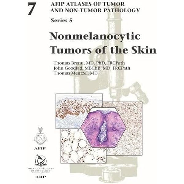 AFIP4th #14 Tumors of the Prostate(新本) Amazon | Tumors of the Prostate Gland, Seminal Vesicles